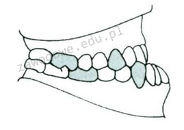 Ilustracja do pytania 33