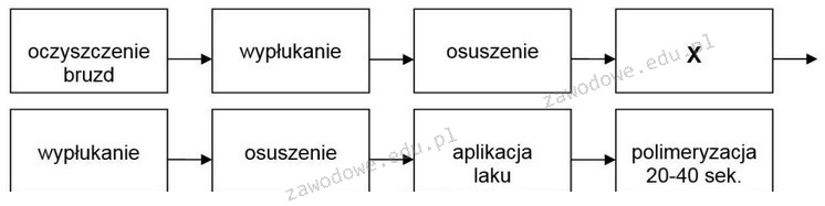 Ilustracja do pytania z kwalifikacji MED.02