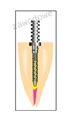 Ilustracja do pytania z kwalifikacji MED.02