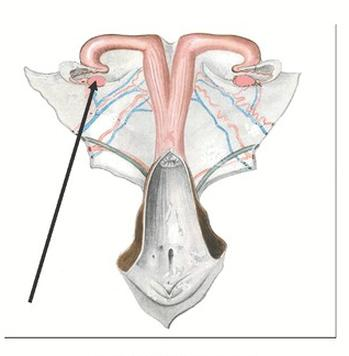Ilustracja do pytania 11