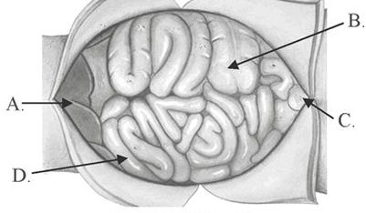 Ilustracja do pytania 3