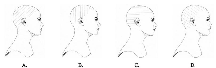 Ilustracja do pytania