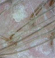 Ilustracja do pytania 14