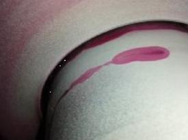 Ilustracja do pytania 16