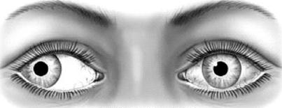 Ilustracja do pytania 18