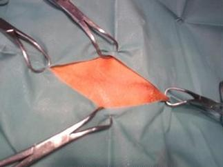 Ilustracja do pytania