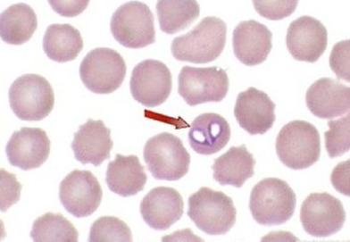 Ilustracja do pytania 30