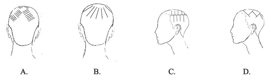 Ilustracja do pytania 14