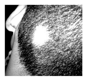 Ilustracja do pytania 4