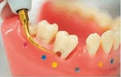 Ilustracja do pytania