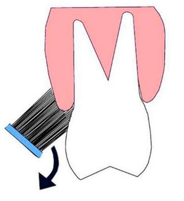 Ilustracja do pytania 14