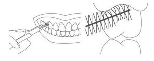 Ilustracja do pytania 18