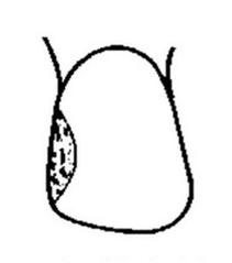 Ilustracja do pytania 18