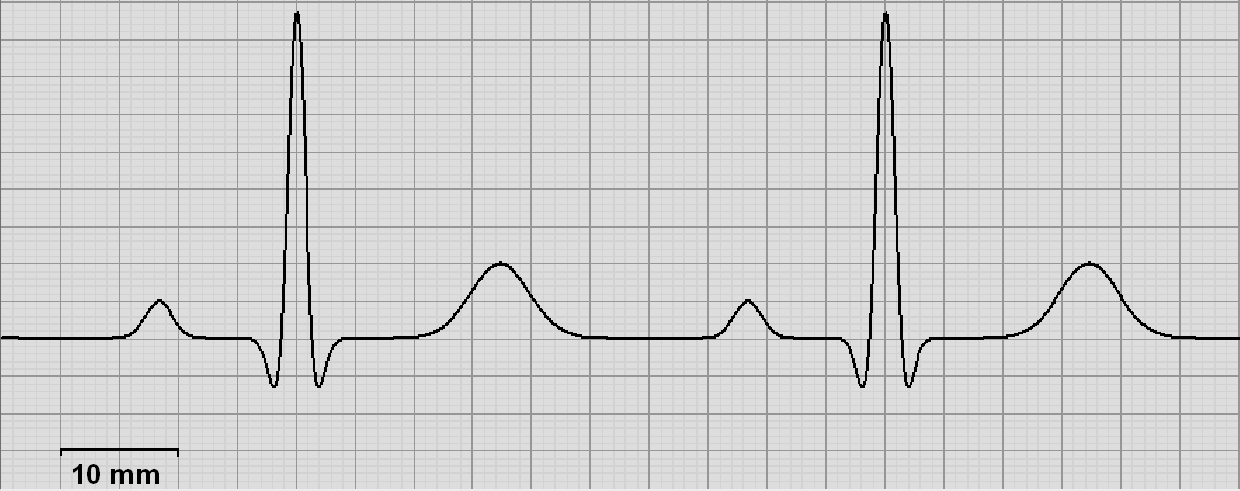 Ilustracja do pytania 7