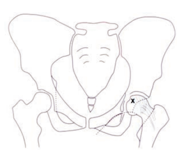 Ilustracja do pytania 19