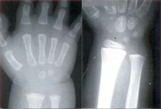 Ilustracja do pytania 20