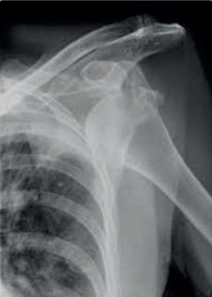 Ilustracja do pytania 16