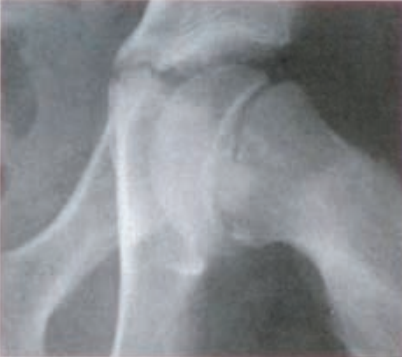 Ilustracja do pytania 19