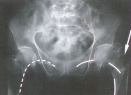 Ilustracja do pytania 38