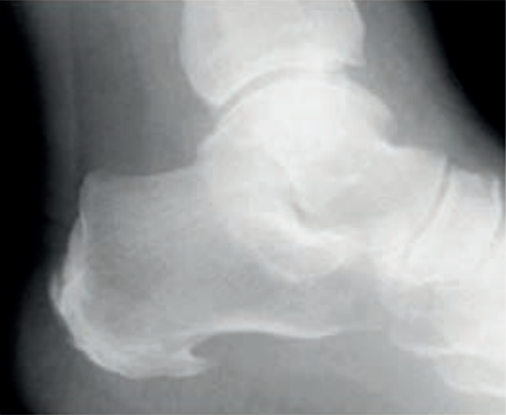 Ilustracja do pytania 3