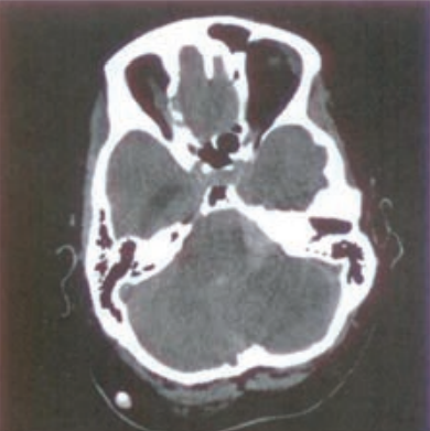 Ilustracja do pytania 19