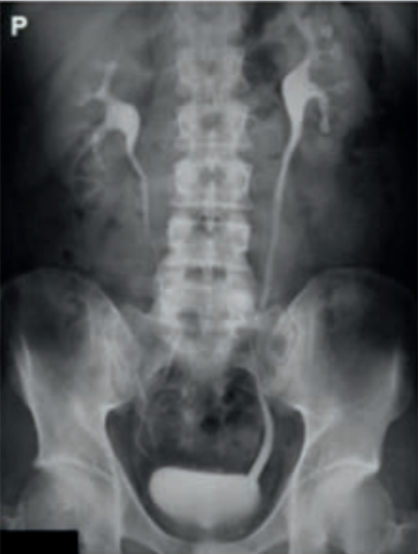 Ilustracja do pytania 32