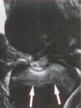 Ilustracja do pytania 7