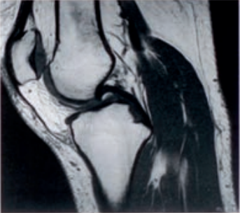 Ilustracja do pytania 2