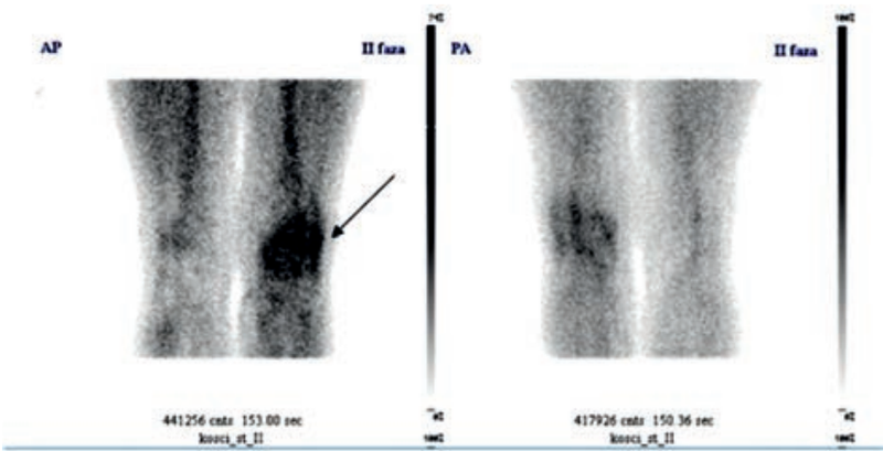 Ilustracja do pytania 20