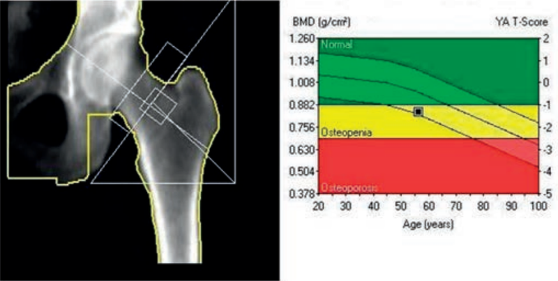 Ilustracja do pytania 9