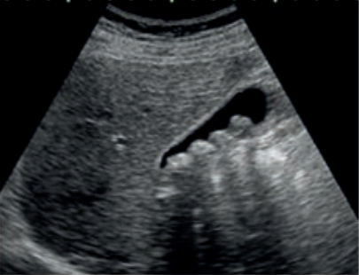 Ilustracja do pytania 33