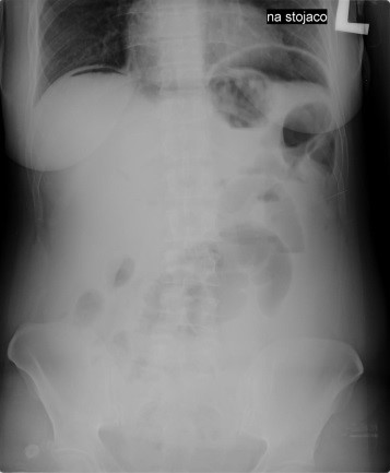 Ilustracja do pytania 26