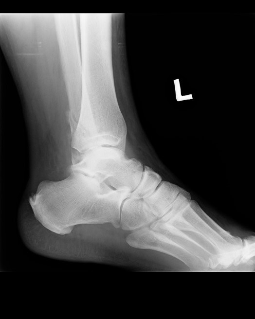 Ilustracja do pytania 9