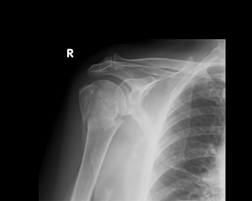 Ilustracja do pytania 15