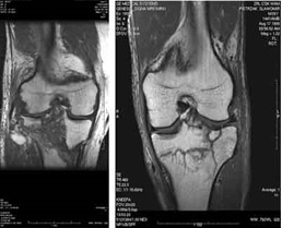 Ilustracja do pytania 37