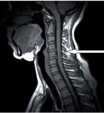 Ilustracja do pytania 27