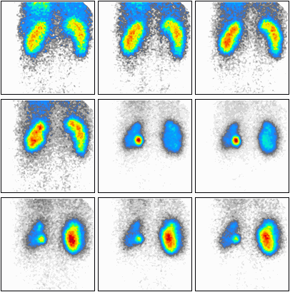 Ilustracja do pytania 9