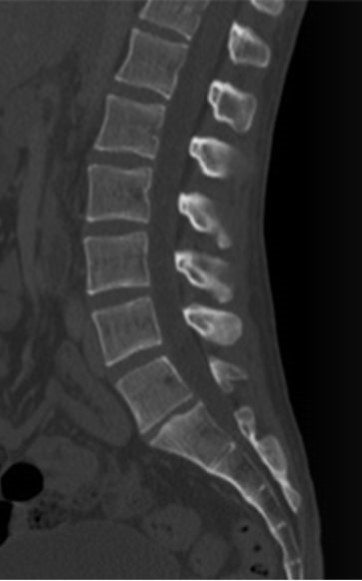 Ilustracja do pytania 31