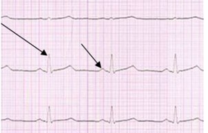 Ilustracja do pytania 35