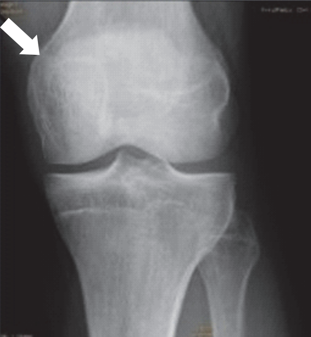 Ilustracja do pytania 27