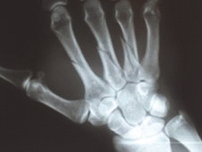 Ilustracja do pytania 30