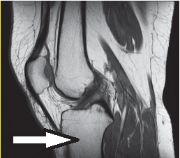 Ilustracja do pytania 13