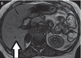 Ilustracja do pytania 39