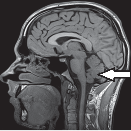 Ilustracja do pytania 28