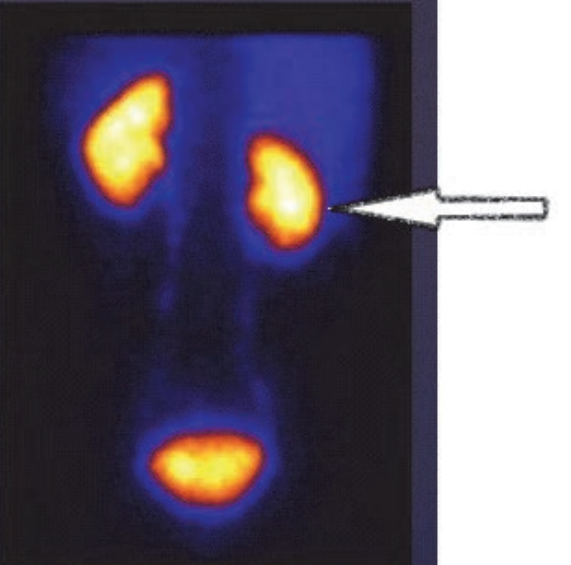 Ilustracja do pytania 35