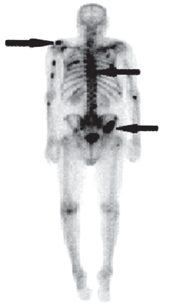 Ilustracja do pytania 11