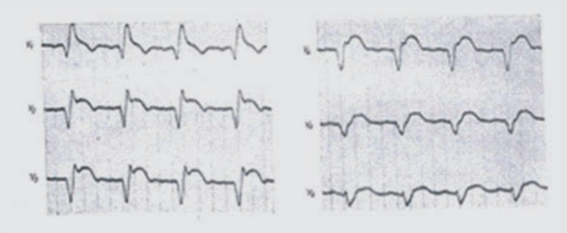 Ilustracja do pytania 20