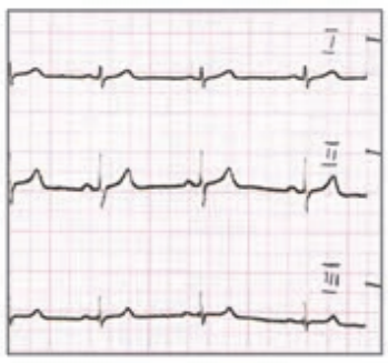 Ilustracja do odpowiedzi C