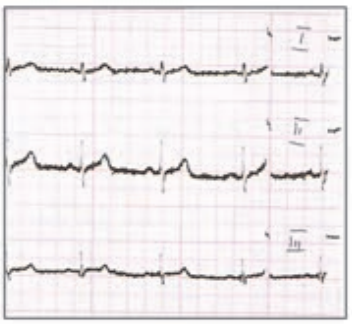 Ilustracja do odpowiedzi D