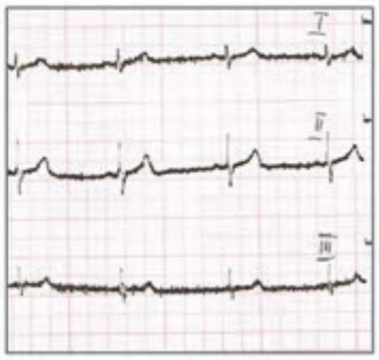 Ilustracja do odpowiedzi A